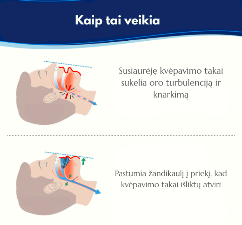 Anti-knarkimo kapa