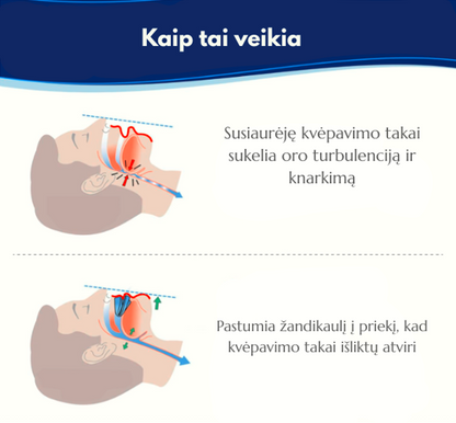 Anti-knarkimo kapa